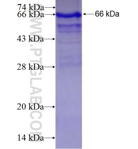 VPRBP fusion protein Ag2184 SDS-PAGE