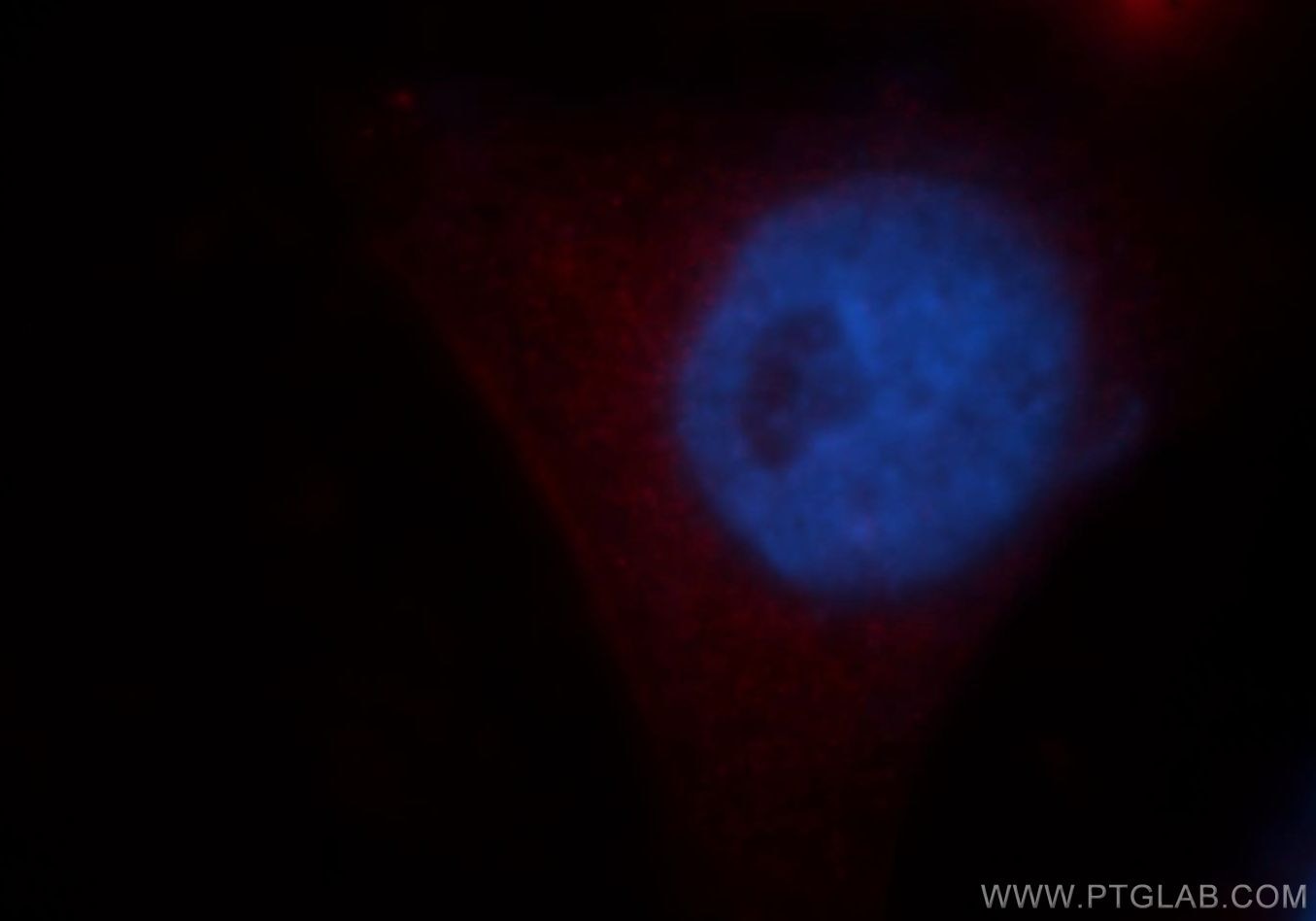 Immunofluorescence (IF) / fluorescent staining of HepG2 cells using VPS11 Polyclonal antibody (19140-1-AP)