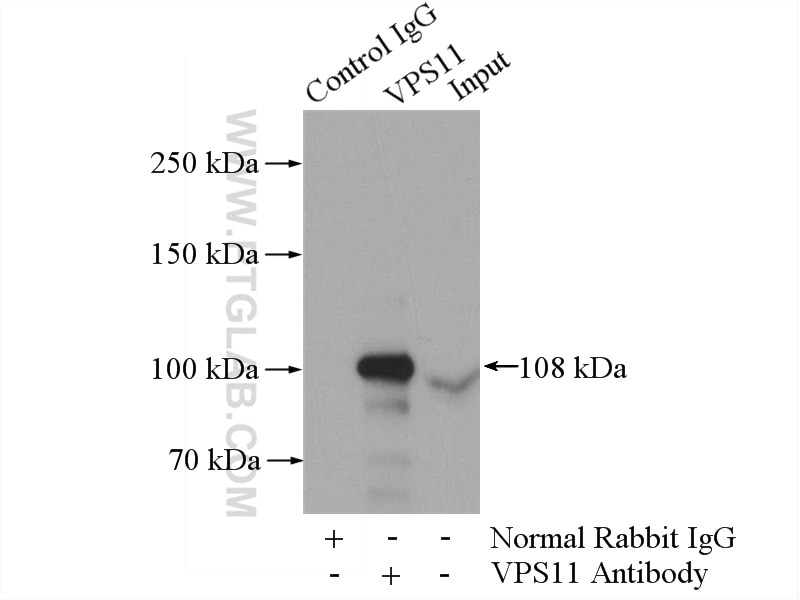 Immunoprecipitation (IP) experiment of HEK-293 cells using VPS11 Polyclonal antibody (19140-1-AP)