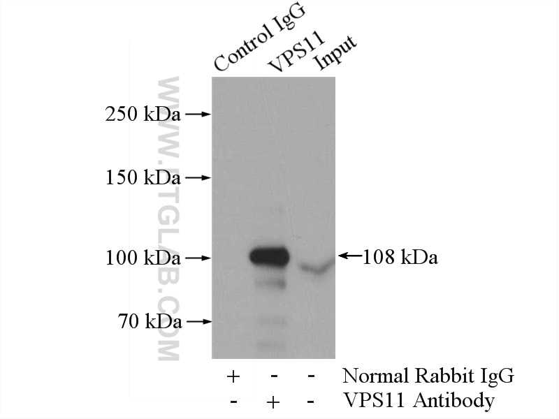 IP experiment of HEK-293 using 19140-1-AP