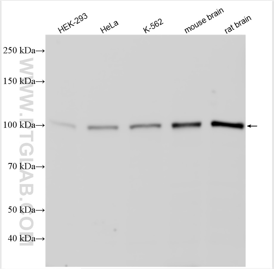 Western Blot (WB) analysis of various lysates using VPS11 Polyclonal antibody (19140-1-AP)