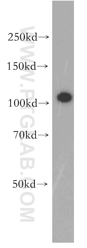 Western Blot (WB) analysis of human brain tissue using VPS11 Polyclonal antibody (19140-1-AP)