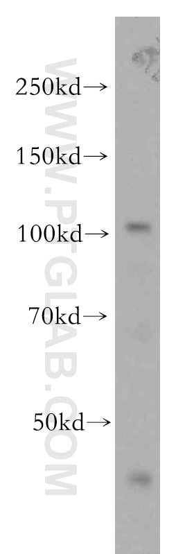 Western Blot (WB) analysis of mouse pancreas tissue using VPS11 Polyclonal antibody (19140-1-AP)