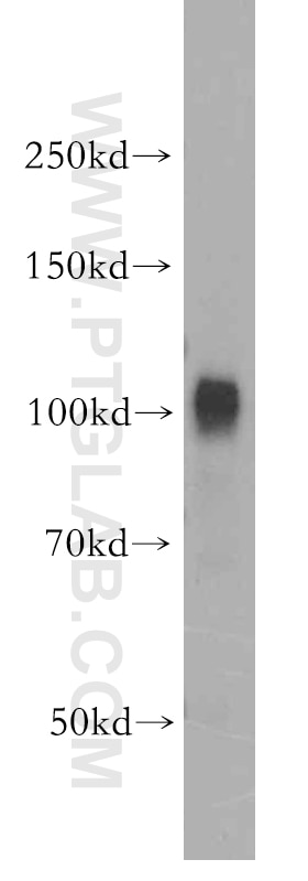 Western Blot (WB) analysis of human kidney tissue using VPS11 Polyclonal antibody (19140-1-AP)
