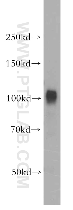 WB analysis of human kidney using 19140-1-AP