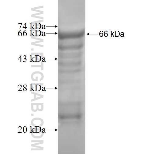 VPS11 fusion protein Ag6225 SDS-PAGE