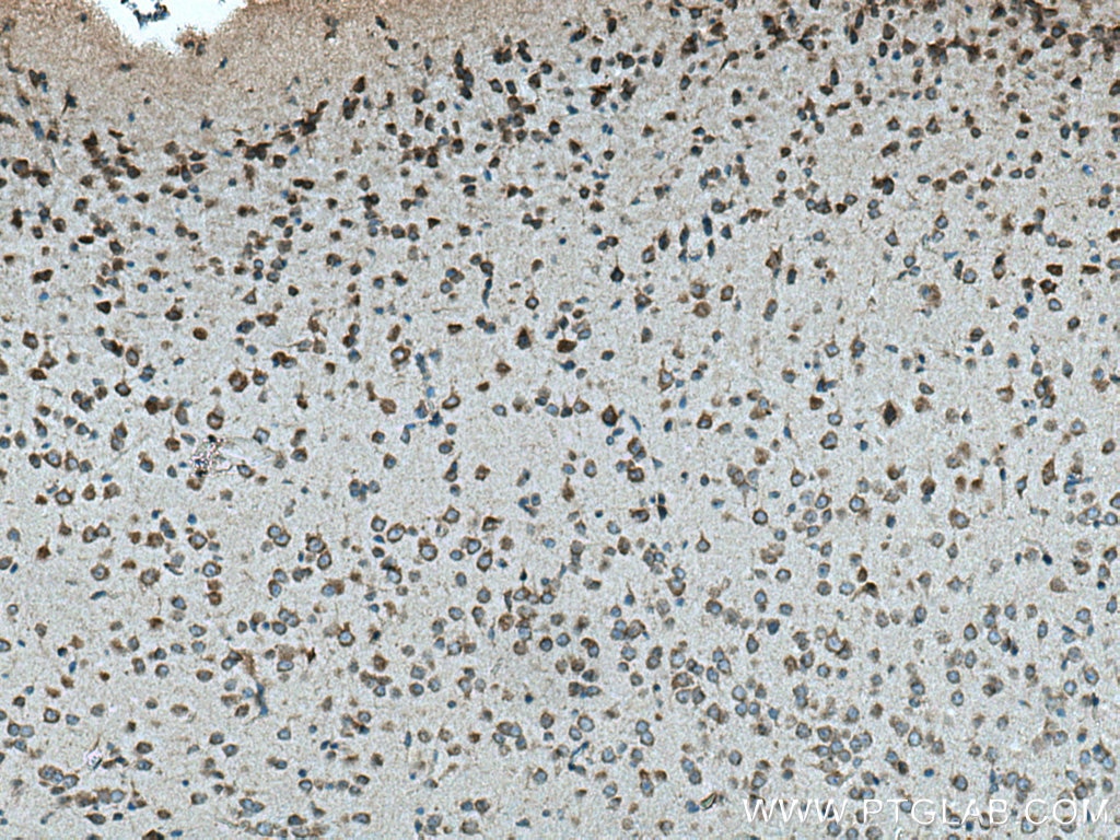 Immunohistochemistry (IHC) staining of mouse brain tissue using VPS13A Polyclonal antibody (28618-1-AP)