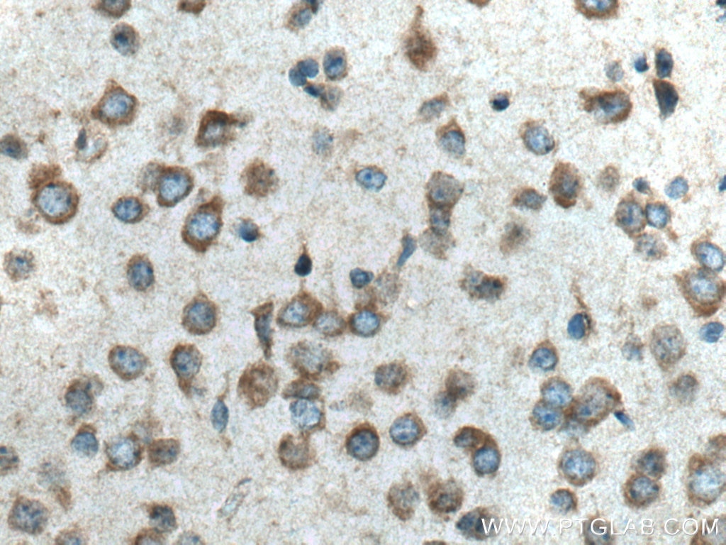 Immunohistochemistry (IHC) staining of mouse brain tissue using VPS13A Polyclonal antibody (28618-1-AP)