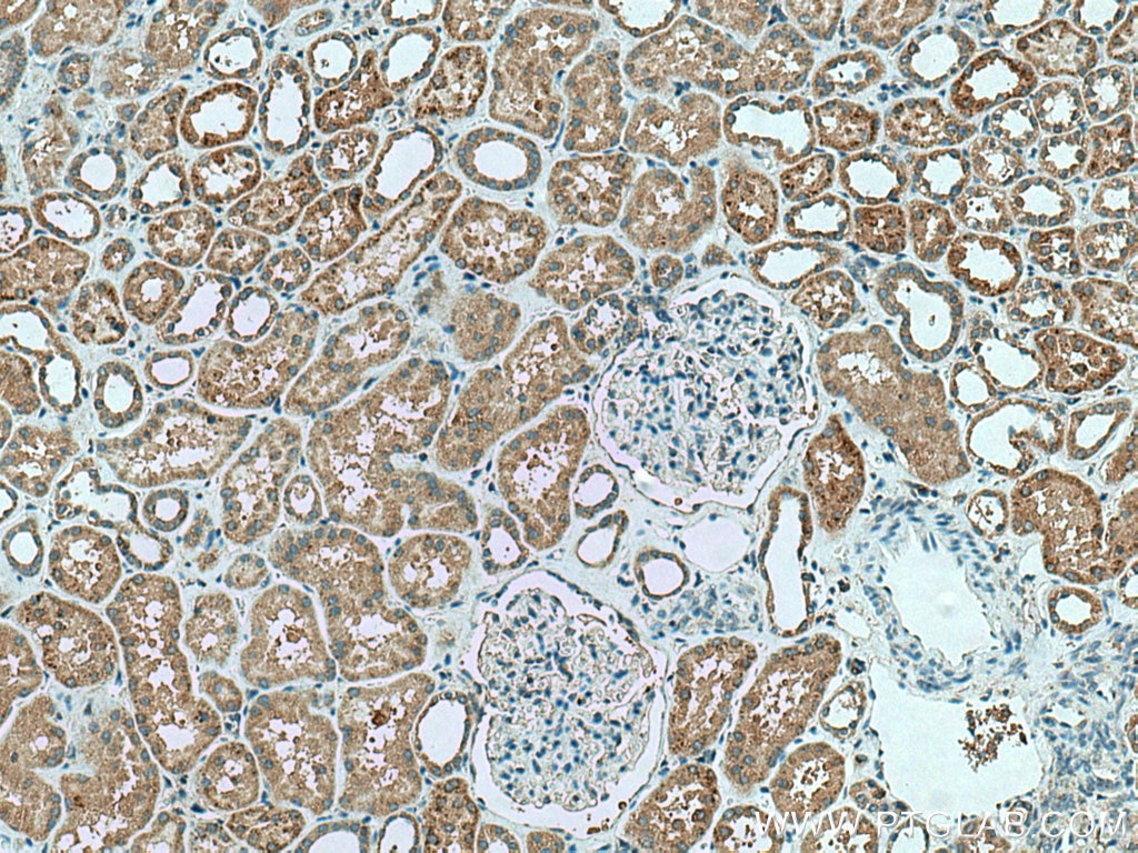 Immunohistochemistry (IHC) staining of human kidney tissue using VPS13A Polyclonal antibody (28618-1-AP)