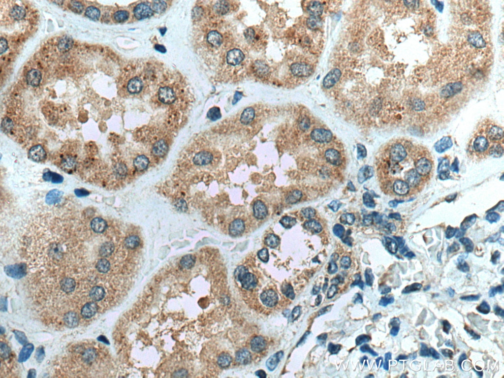 Immunohistochemistry (IHC) staining of human kidney tissue using VPS13A Polyclonal antibody (28618-1-AP)