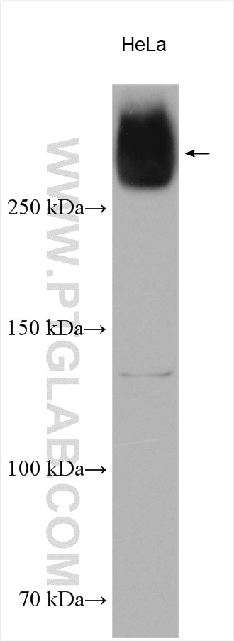 Western Blot (WB) analysis of various lysates using VPS13A Polyclonal antibody (28618-1-AP)