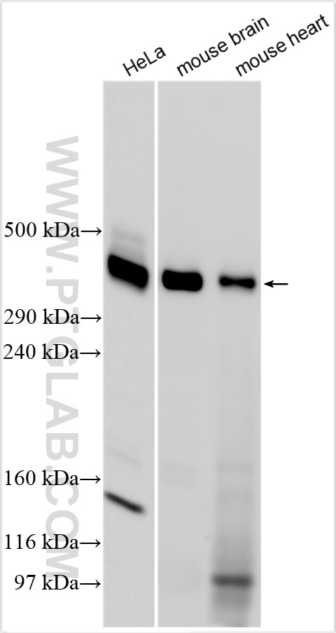 Western Blot (WB) analysis of various lysates using VPS13A Polyclonal antibody (28618-1-AP)