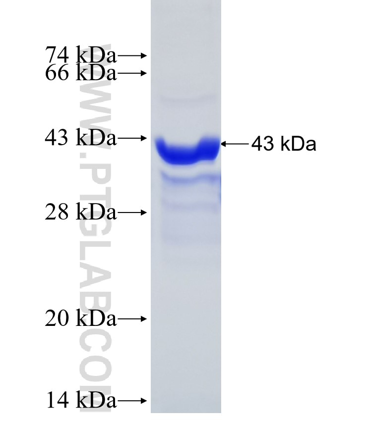 VPS13A fusion protein Ag29532 SDS-PAGE