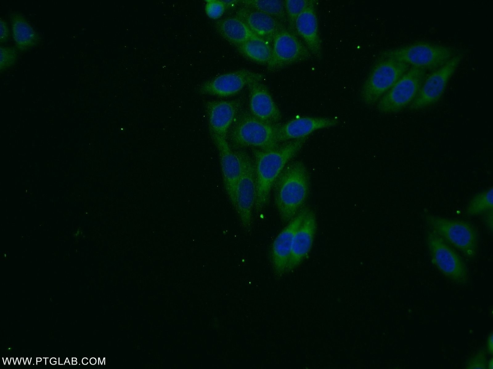 Immunofluorescence (IF) / fluorescent staining of HepG2 cells using VPS13B Polyclonal antibody (24505-1-AP)