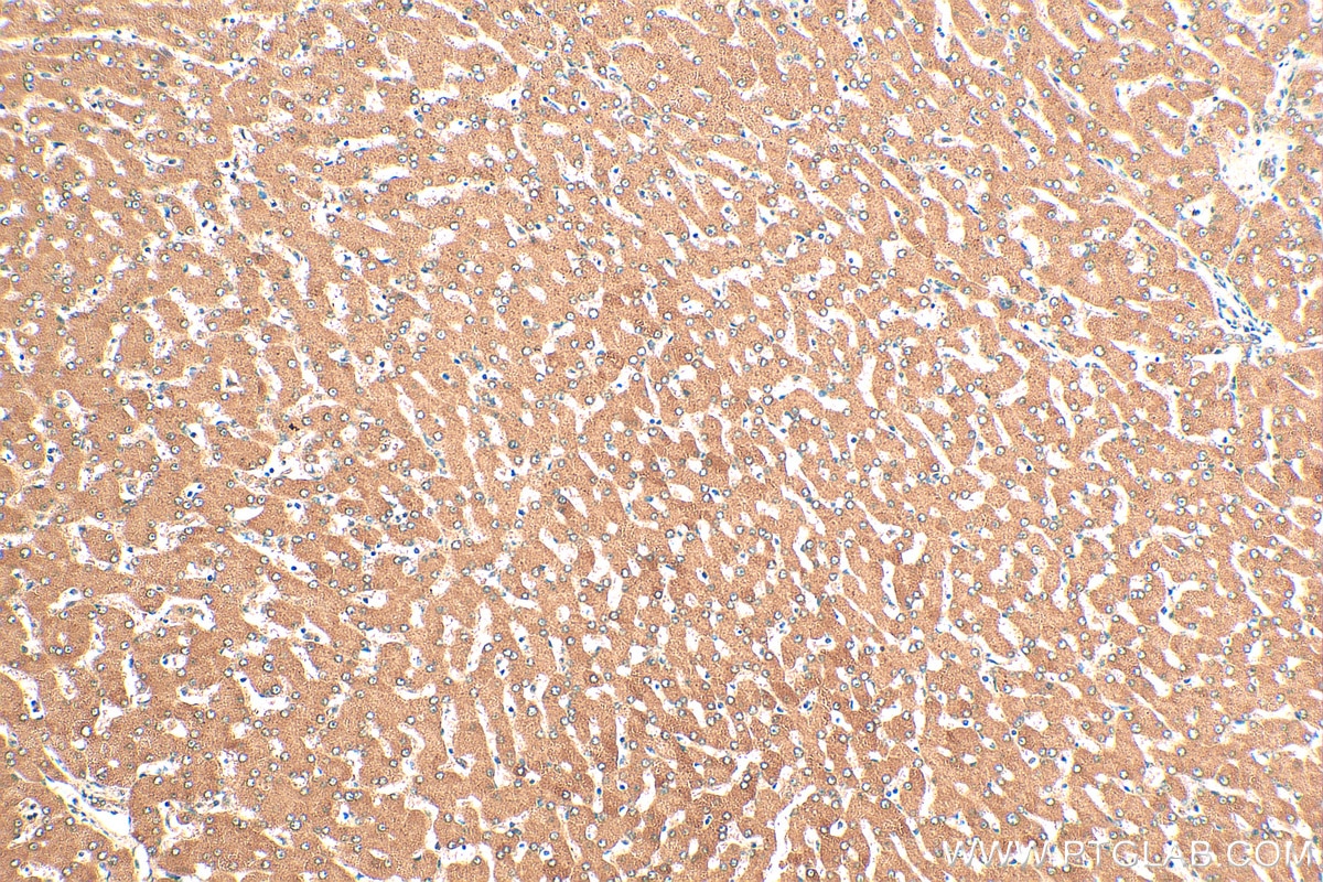 Immunohistochemistry (IHC) staining of human liver tissue using VPS13B Polyclonal antibody (24505-1-AP)
