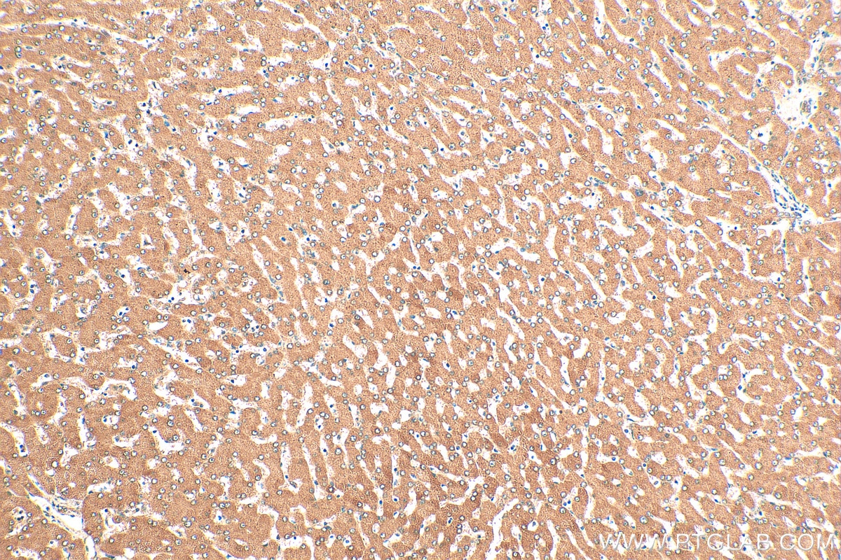 Immunohistochemistry (IHC) staining of human liver tissue using VPS13B Polyclonal antibody (24505-1-AP)