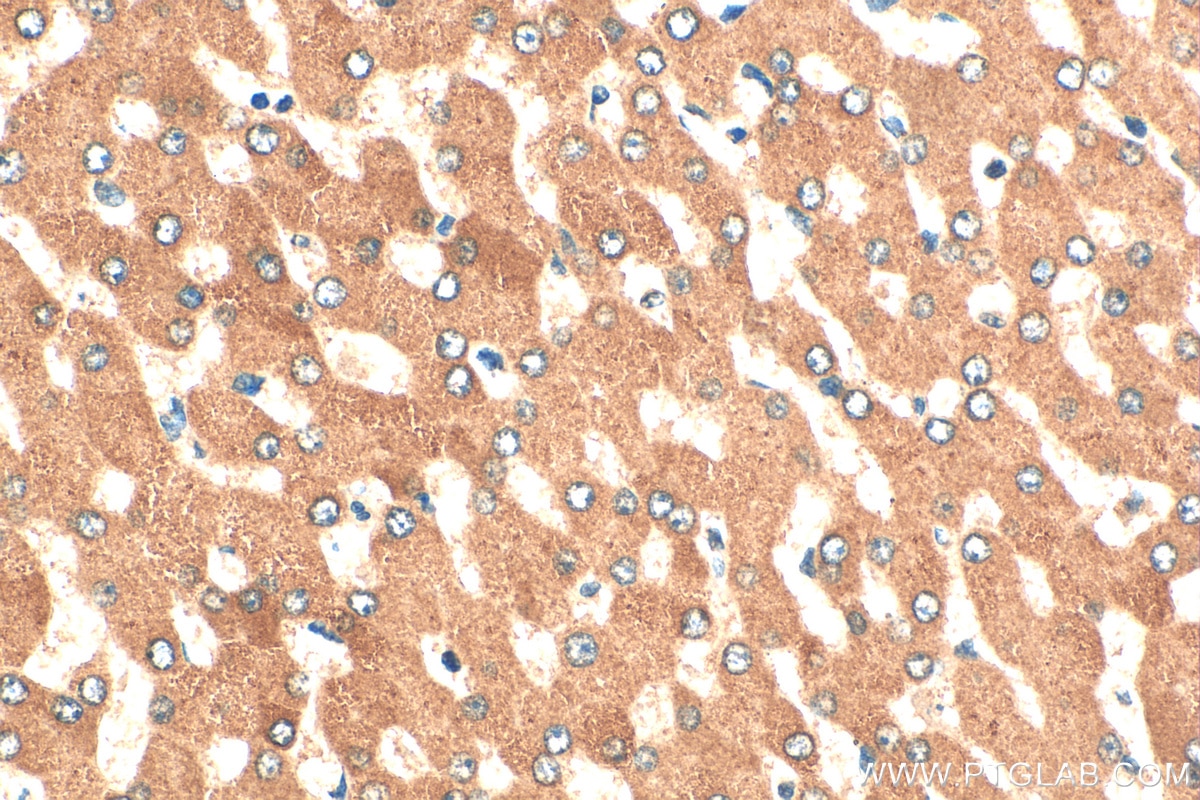 Immunohistochemistry (IHC) staining of human liver tissue using VPS13B Polyclonal antibody (24505-1-AP)