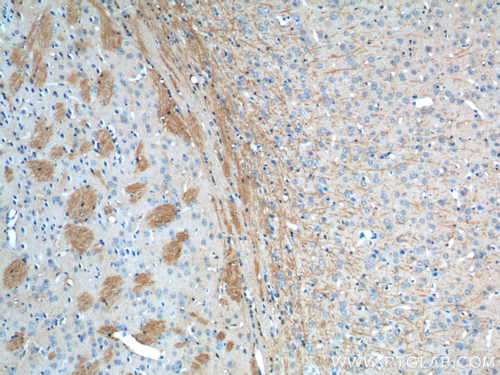 Immunohistochemistry (IHC) staining of mouse brain tissue using VPS13B Polyclonal antibody (24505-1-AP)