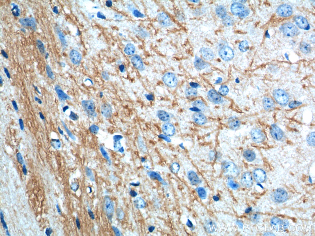 Immunohistochemistry (IHC) staining of mouse brain tissue using VPS13B Polyclonal antibody (24505-1-AP)