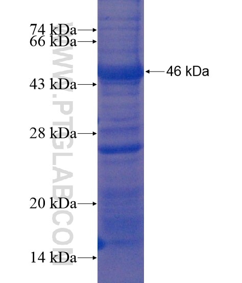 VPS13B fusion protein Ag21368 SDS-PAGE