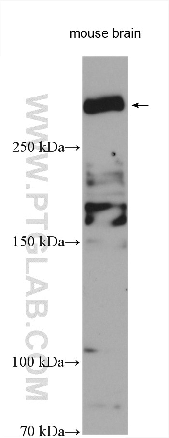 Western Blot (WB) analysis of various lysates using VPS13C Polyclonal antibody (28676-1-AP)