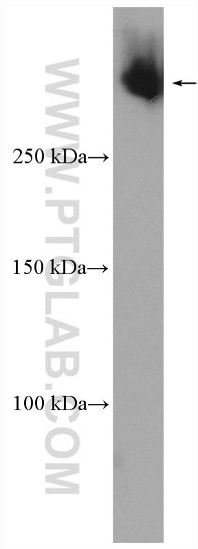 WB analysis of HeLa using 28676-1-AP