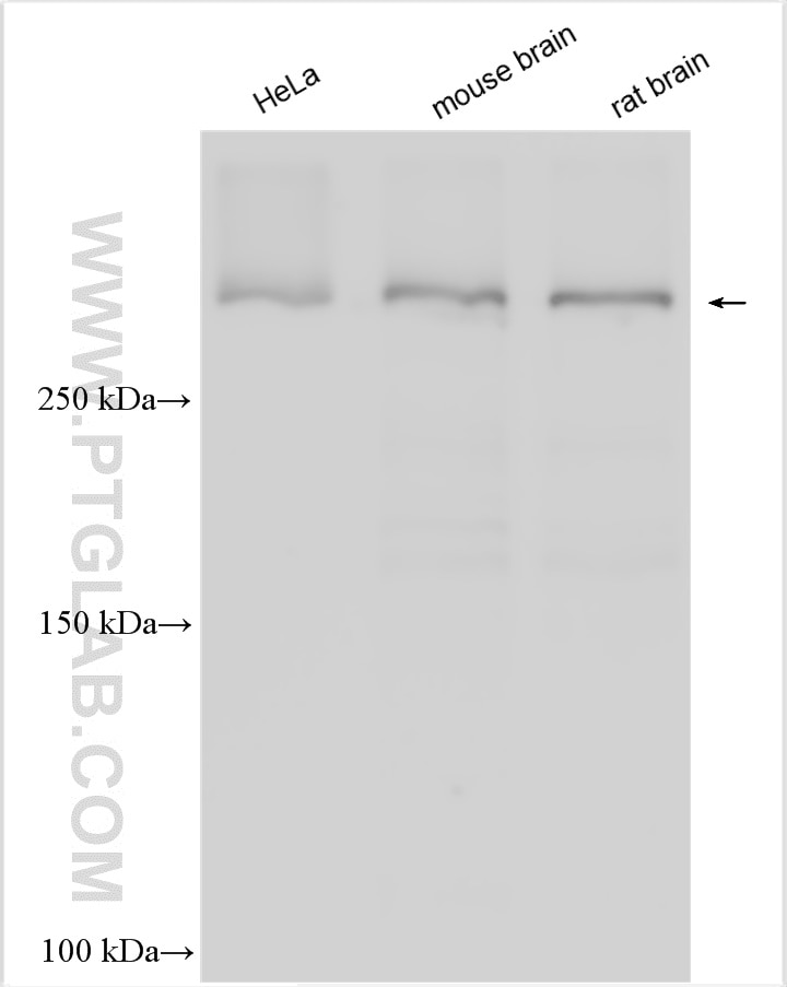 Western Blot (WB) analysis of various lysates using VPS13C Polyclonal antibody (28676-1-AP)