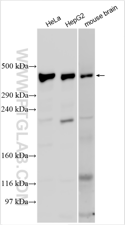 Western Blot (WB) analysis of various lysates using VPS13C Polyclonal antibody (29844-1-AP)