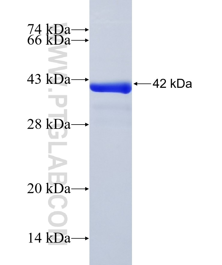 VPS13C fusion protein Ag29434 SDS-PAGE