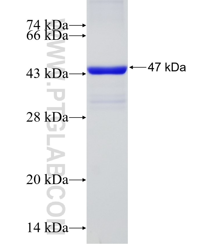 VPS13C fusion protein Ag31069 SDS-PAGE