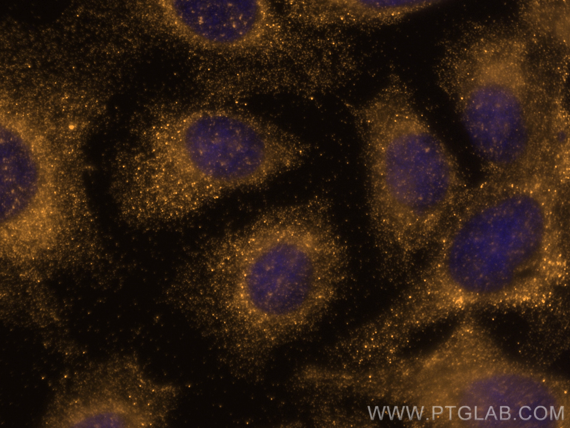 Immunofluorescence (IF) / fluorescent staining of U2OS cells using VPS13D Polyclonal antibody (29387-1-AP)