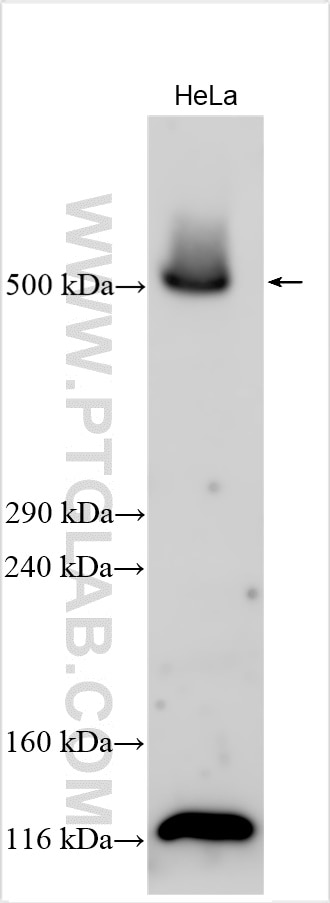 Western Blot (WB) analysis of various lysates using VPS13D Polyclonal antibody (29387-1-AP)