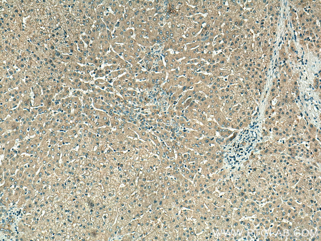 Immunohistochemistry (IHC) staining of human liver tissue using VPS16 Polyclonal antibody (17776-1-AP)