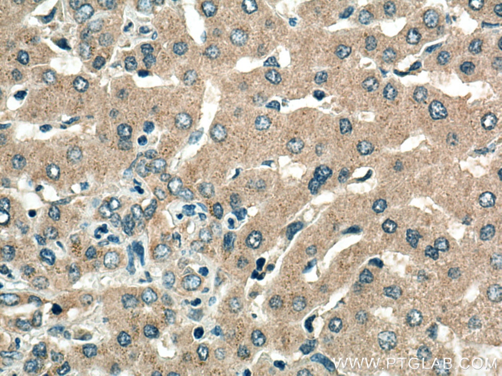 Immunohistochemistry (IHC) staining of human liver tissue using VPS16 Polyclonal antibody (17776-1-AP)