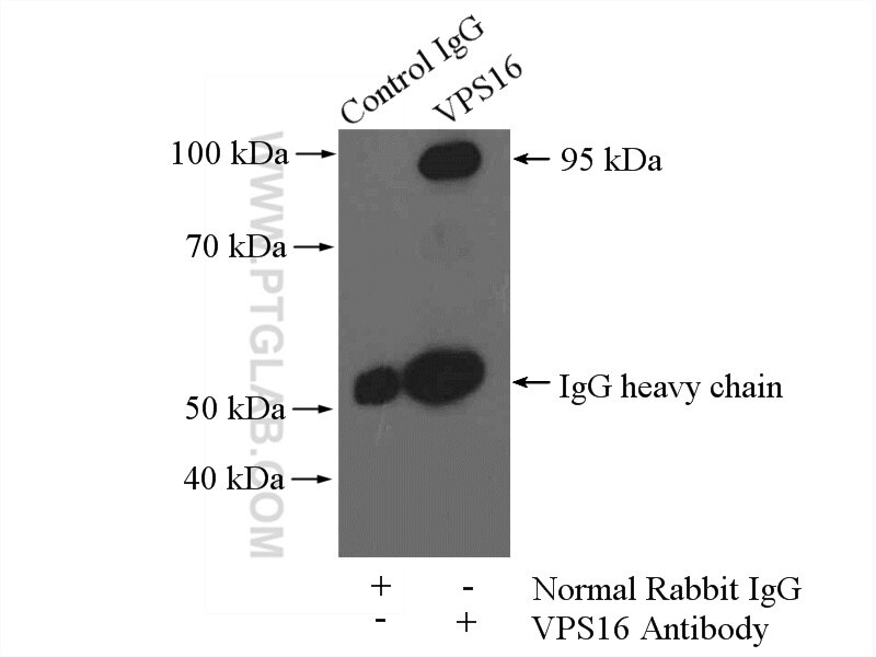 VPS16 Polyclonal antibody