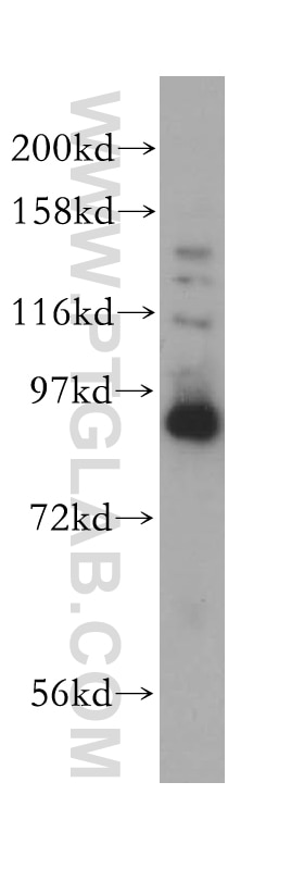 Western Blot (WB) analysis of HeLa cells using VPS16 Polyclonal antibody (17776-1-AP)