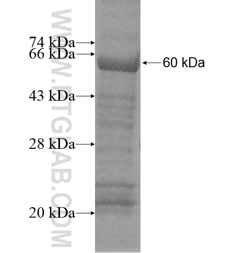 VPS16 fusion protein Ag12202 SDS-PAGE
