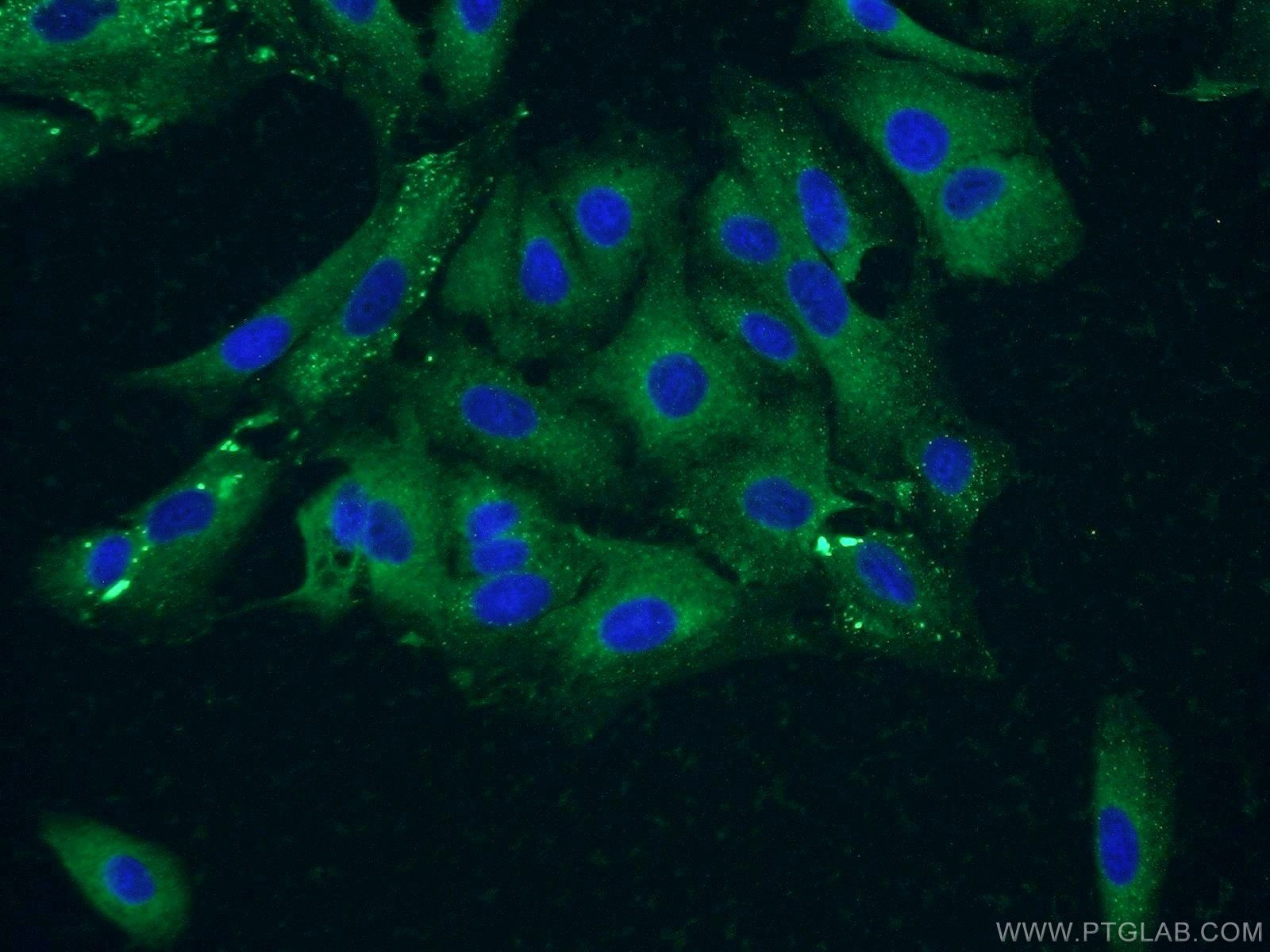 Immunofluorescence (IF) / fluorescent staining of A549 cells using VPS18 Polyclonal antibody (10901-1-AP)