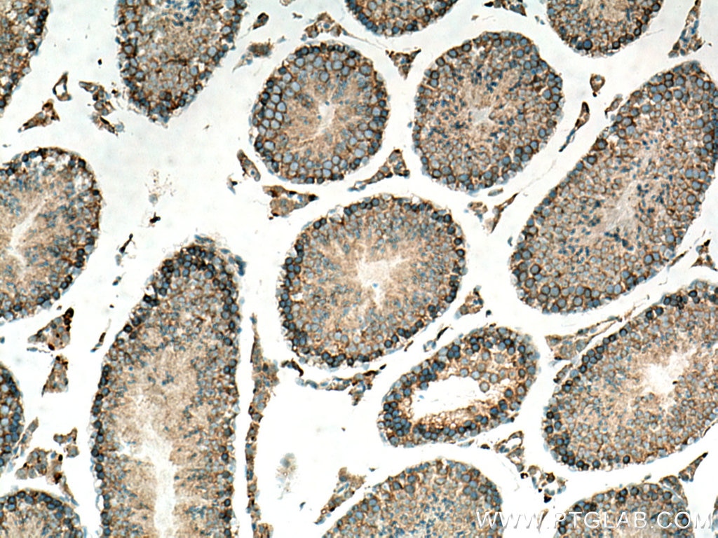 IHC staining of mouse testis using 10901-1-AP