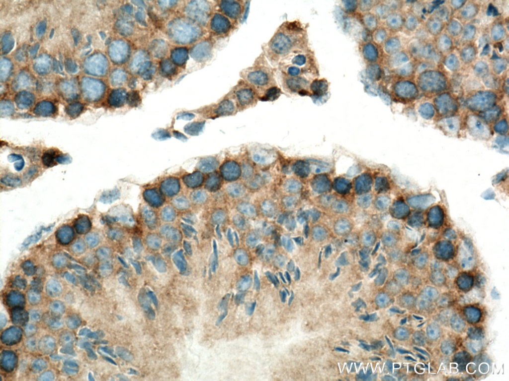Immunohistochemistry (IHC) staining of mouse testis tissue using VPS18 Polyclonal antibody (10901-1-AP)