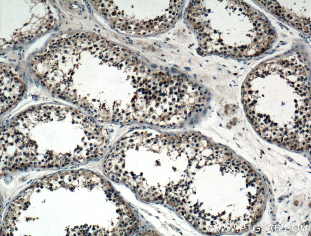 Immunohistochemistry (IHC) staining of human testis tissue using VPS18 Polyclonal antibody (10901-1-AP)