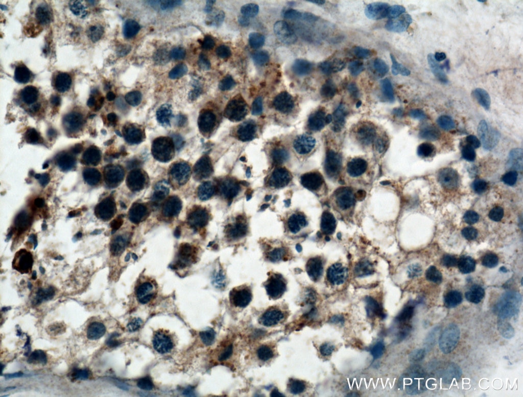 Immunohistochemistry (IHC) staining of human testis tissue using VPS18 Polyclonal antibody (10901-1-AP)