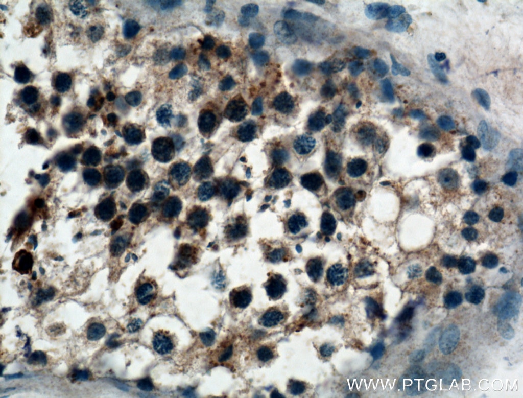 IHC staining of human testis using 10901-1-AP