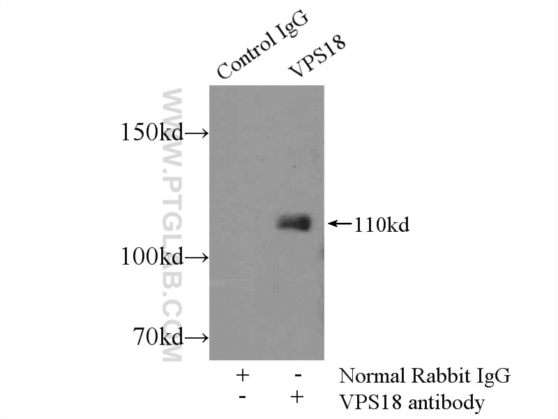 Immunoprecipitation (IP) experiment of HeLa cells using VPS18 Polyclonal antibody (10901-1-AP)