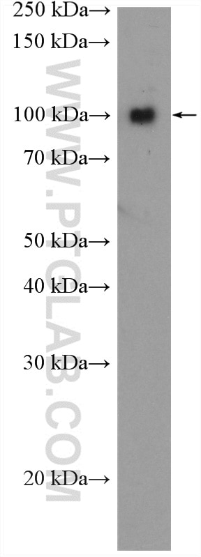 Western Blot (WB) analysis of mouse brain tissue using VPS18 Polyclonal antibody (10901-1-AP)