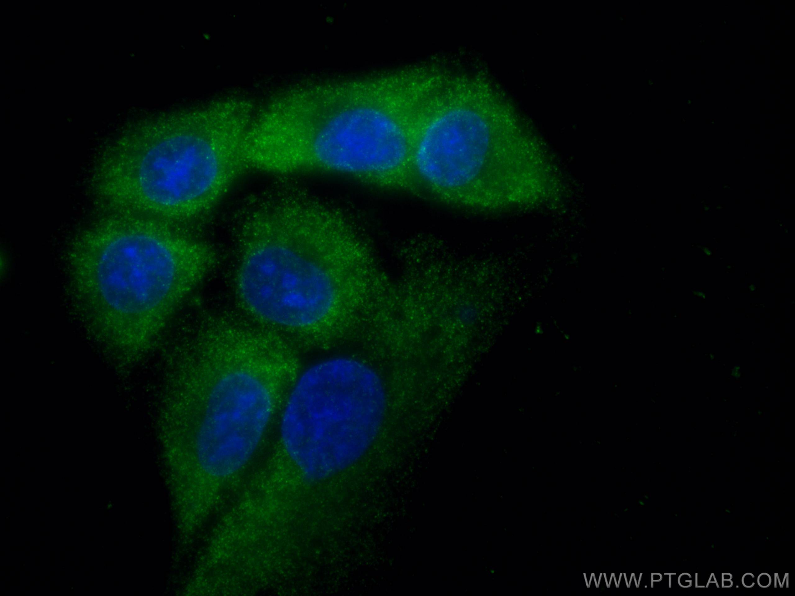 Immunofluorescence (IF) / fluorescent staining of A549 cells using VPS18 Monoclonal antibody (67590-1-Ig)