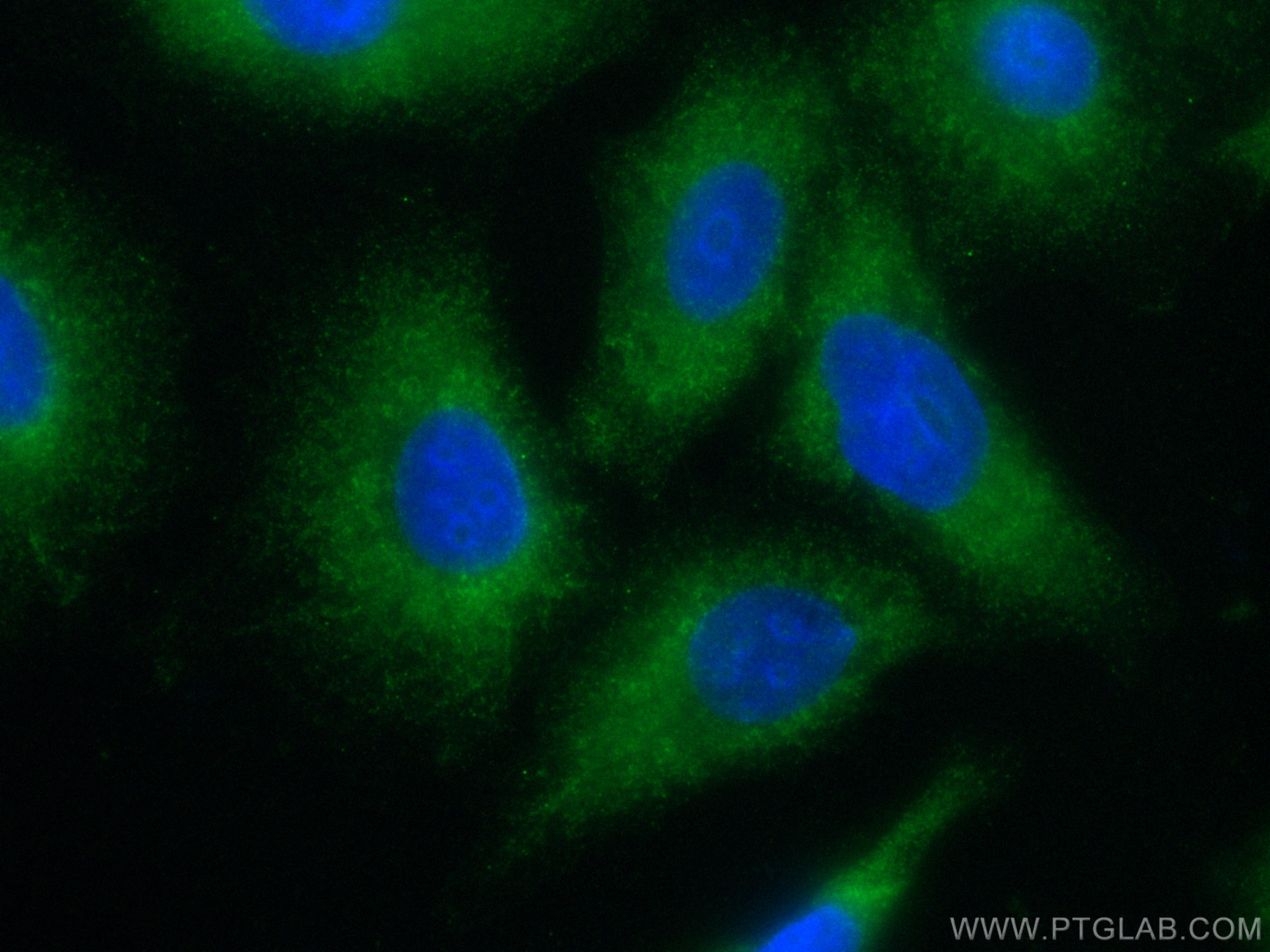 Immunofluorescence (IF) / fluorescent staining of A549 cells using CoraLite® Plus 488-conjugated VPS18 Monoclonal ant (CL488-67590)
