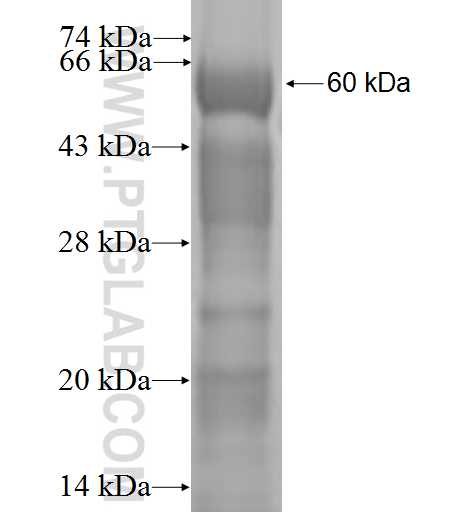 VPS18 fusion protein Ag1140 SDS-PAGE