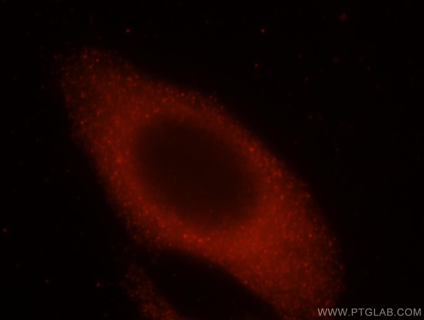 Immunofluorescence (IF) / fluorescent staining of HepG2 cells using VPS24 Polyclonal antibody (15472-1-AP)