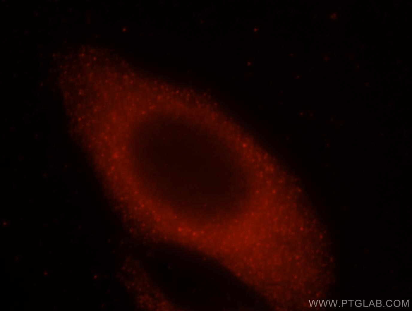 IF Staining of HepG2 using 15472-1-AP